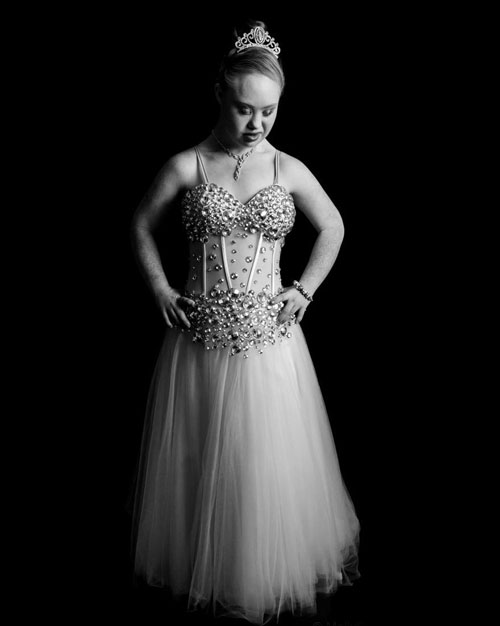 Cô gái bị down, mắt lé, miệng lệch, giảm 20kg thành người mẫu - 9