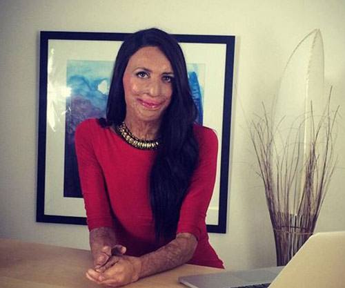 Chuyện tình cảm động được ngưỡng mộ nhất nước Úc - 12