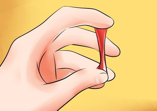 Dấu hiệu nhận biết bệnh ung thư phụ khoa - 1