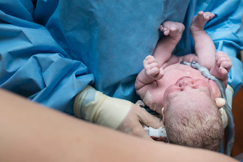 Hình ảnh tuyệt đẹp về dây rốn của bé khi mới chào đời - 9
