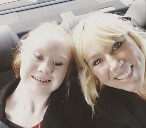 Cô gái bị down, mắt lé, miệng lệch, giảm 20kg thành người mẫu - 11