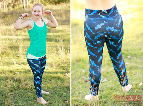 Cô gái bị down, mắt lé, miệng lệch, giảm 20kg thành người mẫu - 4