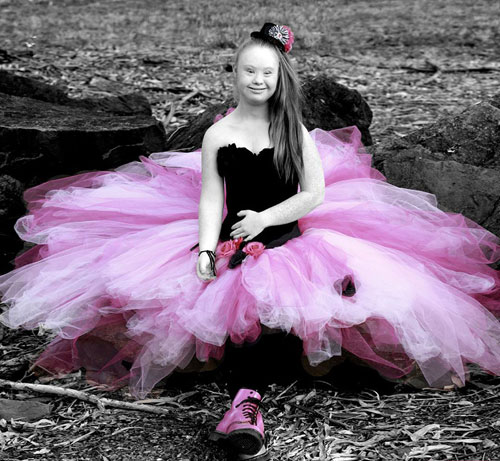 Cô gái bị down, mắt lé, miệng lệch, giảm 20kg thành người mẫu - 6