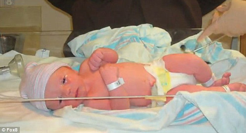 Cậu bé nhớ kiếp trước là phụ nữ chết trong một vụ cháy - 6