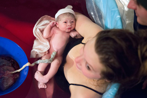 Hình ảnh tuyệt đẹp về dây rốn của bé khi mới chào đời - 6