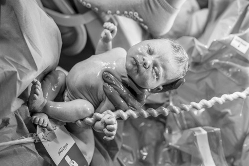 Hình ảnh tuyệt đẹp về dây rốn của bé khi mới chào đời - 8