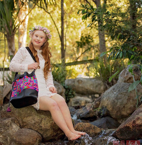 Cô gái bị down, mắt lé, miệng lệch, giảm 20kg thành người mẫu - 2