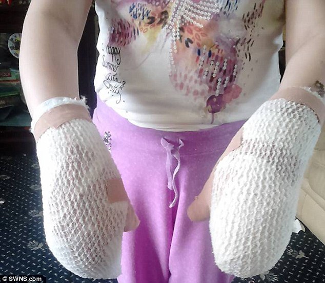 Ngò tây dại gây bỏng rộp, mù lòa nếu vô tình chạm phải - 5